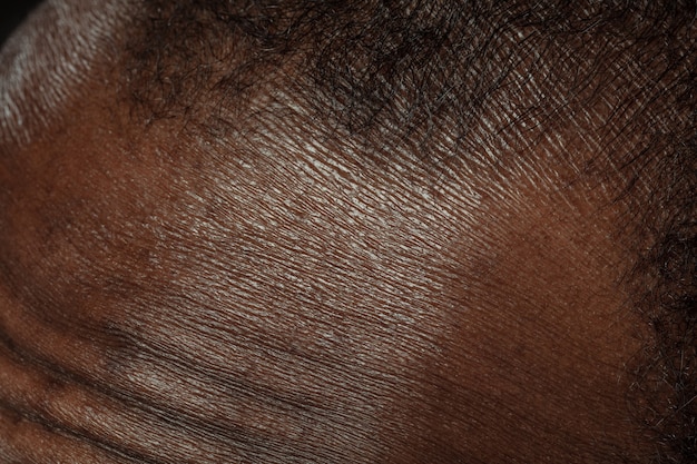 Cabeça, rosto. Textura detalhada da pele humana. Close-up tiro do jovem corpo masculino afro-americano. Conceito de skincare, bodycare, saúde, higiene e medicina. Parece bonito e bem cuidado. Dermatologia.