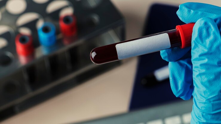 Foto grátis cirurgião segurando um tubo de ensaio de sangue para coronavírus