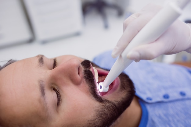 Close-up da boca do paciente em check-up odontológico
