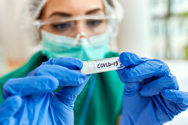 Closeup de epidemiologista com amostra COVID19 em tubo de ensaio