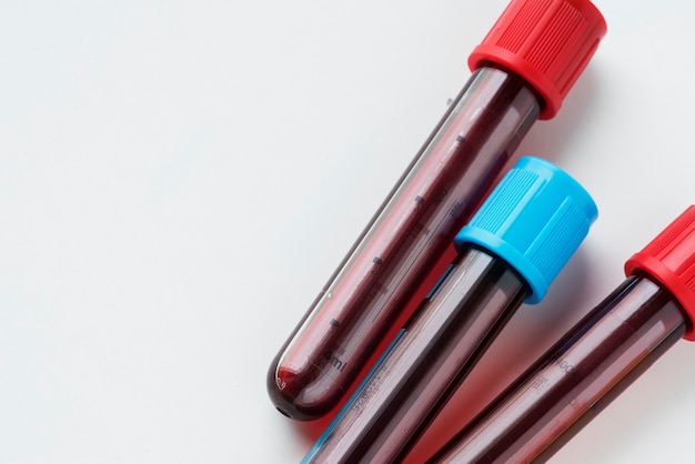 Foto grátis closeup, de, sangue, tubo, teste