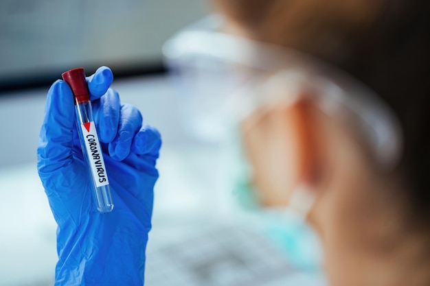 Closeup de técnico médico segurando tubo de ensaio com coronavírus enquanto trabalhava em laboratório