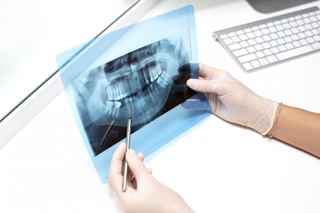 Dentista examina foto de raio-x dos dentes