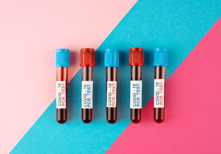 Foto grátis disposição dos testes pcr do coronavirus acima, vista