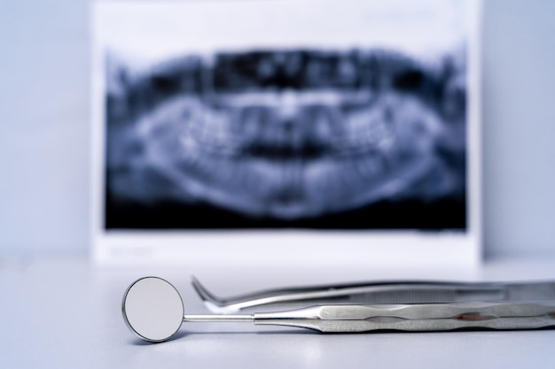 Espelho dental em fundo desfocado de raio-x. ferramentas para atendimento odontológico e próteses. foco seletivo.