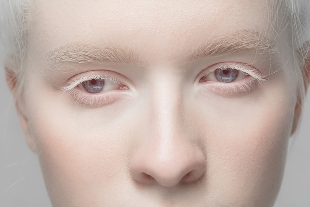 Feche o retrato de uma linda mulher albina isolada no estúdio. . detalhes.