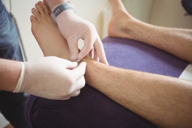 Fisioterapeuta realizando agulhamento seco na perna de um paciente