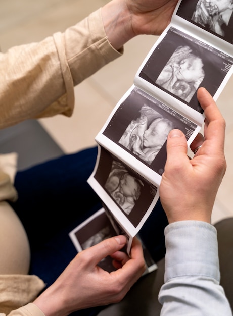 Ginecologista oferecendo fotos de ultrassom de casal