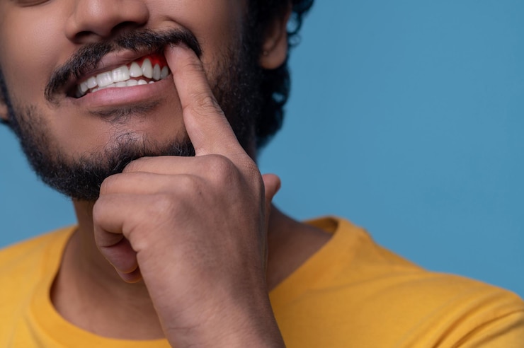 Foto grátis homem adulto mostrando sua doença periodontal diante da câmera
