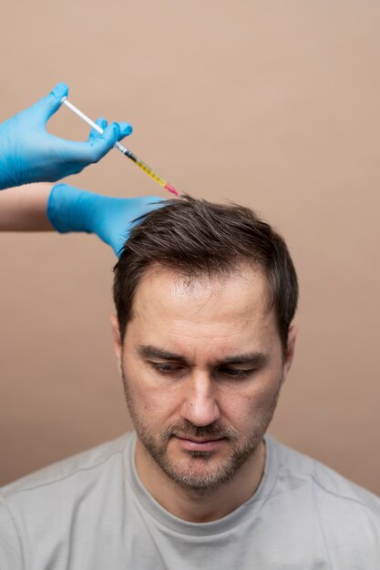 Homem de alto ângulo a receber injecção de PrP para alopecia