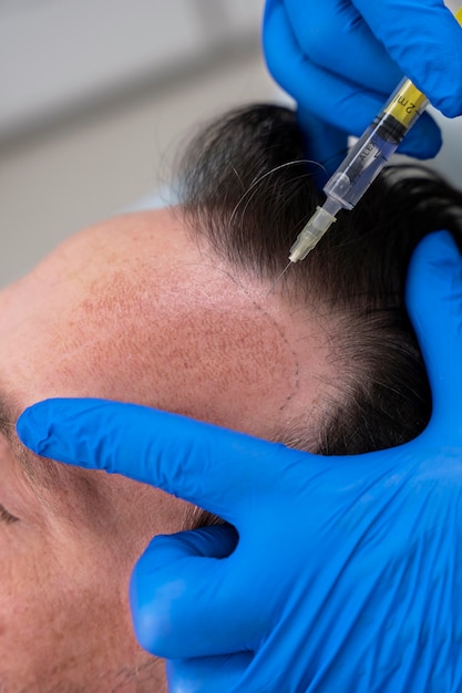 Homem recebendo tratamento para queda de cabelo