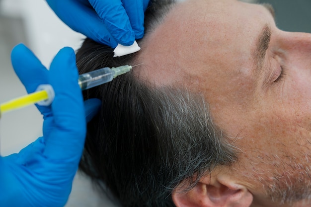 Homem recebendo tratamento para queda de cabelo