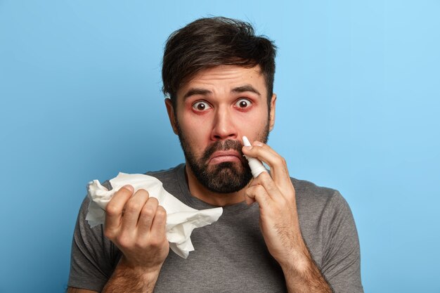 Homem surpreso com barba por fazer sofre de vírus da gripe sazonal, resfriado nasal, cura nariz entupido com gotas nasais, segura lenço, limpa o entupimento, tem rinite alérgica, sente-se mal