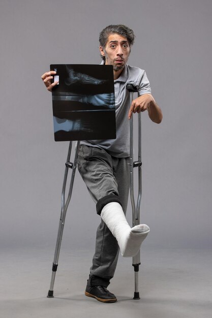 Jovem do sexo masculino com o pé quebrado usando muletas e segurando o raio-x na parede cinza, vista frontal, incapacitar acidente torção pé dor quebrado