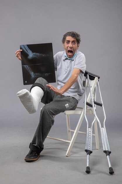 Jovem do sexo masculino sentado com o pé quebrado segurando um raio-x na parede cinza Dor na perna acidente torção do pé masculino