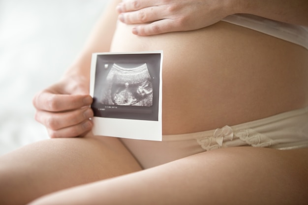 Foto grátis jovem grávida mostrando imagem ultra-sônica de seu bebê