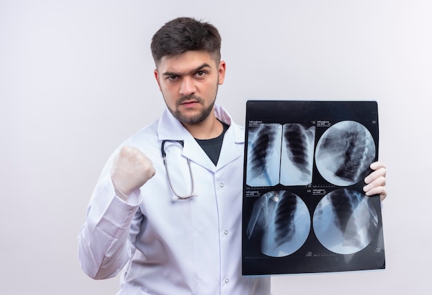 Jovem médico bonito usando jaleco branco, luvas médicas e estetoscópio mostrando o punho com raiva, segurando uma tomografia em pé sobre uma parede branca