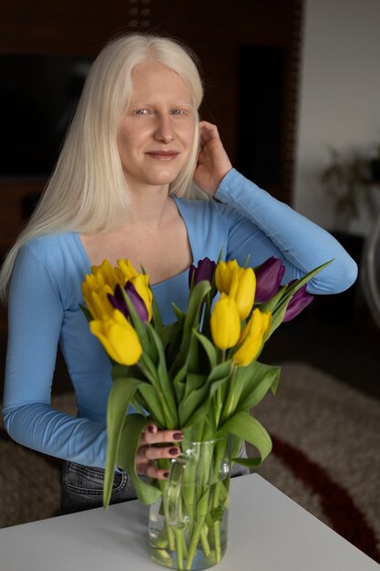 Jovem mulher com albinismo e flores de tulipa