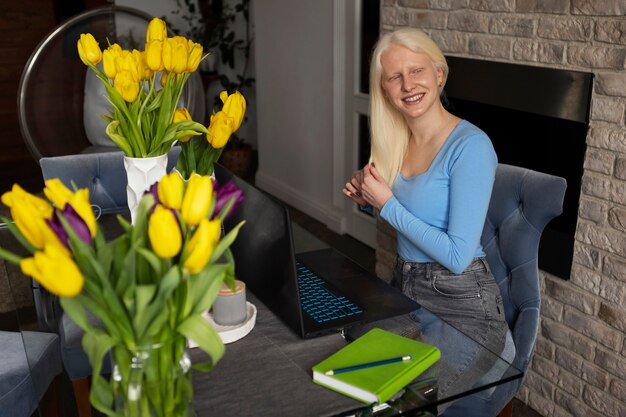 Jovem mulher com albinismo e flores de tulipa