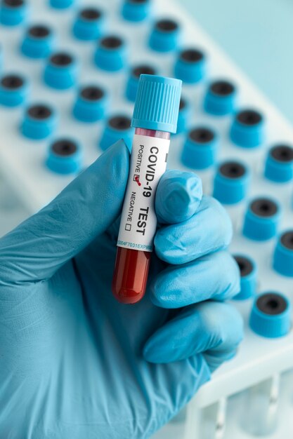 Mão com luvas de proteção segurando uma amostra de sangue para teste ambíguo