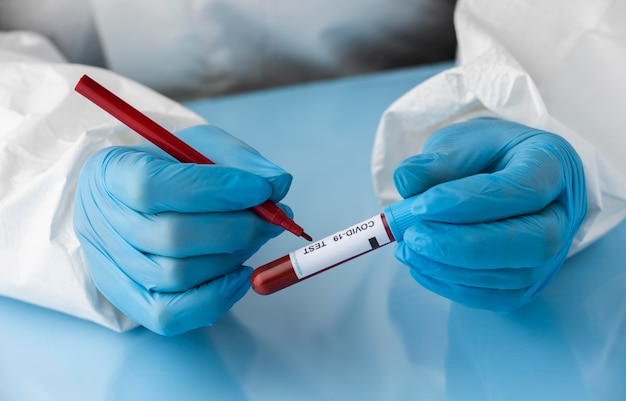 Mão com luvas de proteção segurando uma amostra de sangue para teste ambíguo