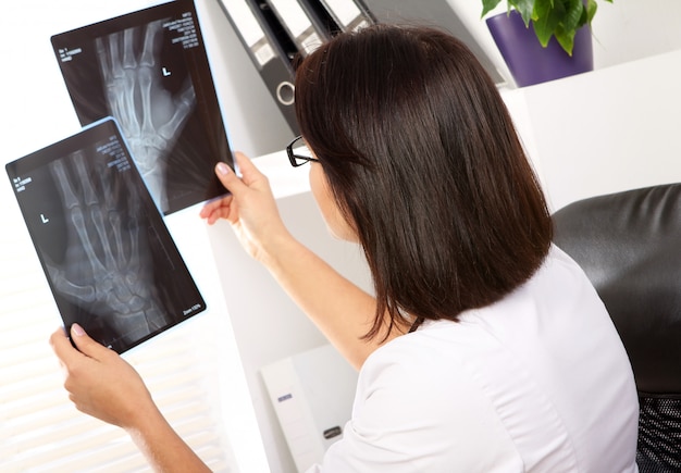 Foto grátis médico da mulher está olhando o raio x da mão quebrada