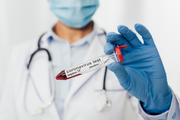 Médico de close-up segurando teste de coronavírus Foto gratuita