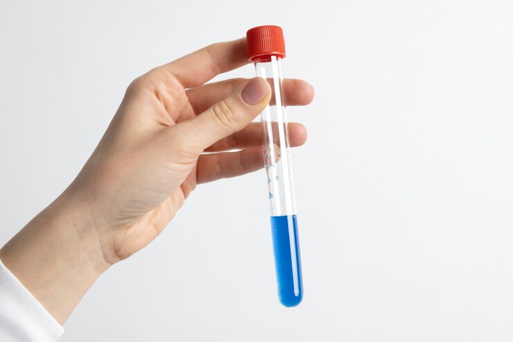 Foto grátis médico de laboratório realizando exame médico de urina
