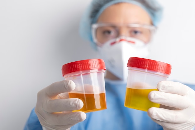 Foto grátis médico de laboratório realizando exame médico de urina