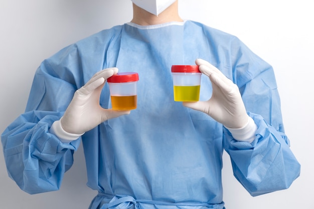 Foto grátis médico de laboratório realizando exame médico de urina
