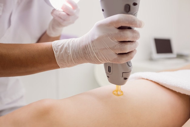 Médico realizando depilação a laser na pele do paciente do sexo feminino na clínica