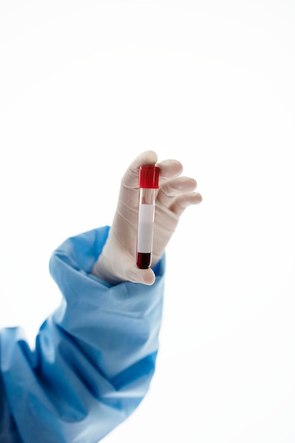 Médico segurando um tubo de ensaio de sangue