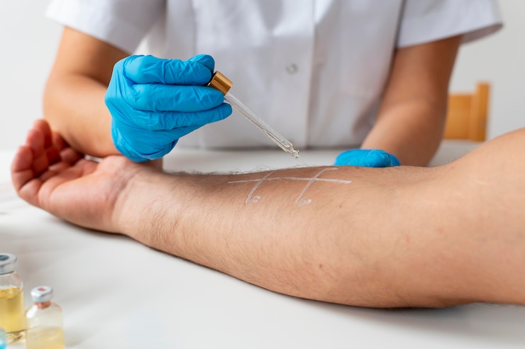 Foto grátis médico verificando a alergia cutânea de uma pessoa
