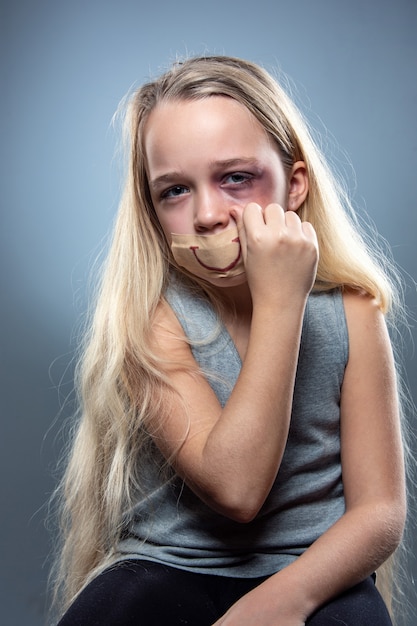 Foto grátis menina triste e assustada com olhos vermelhos e machucados e sorriso falso na boca.