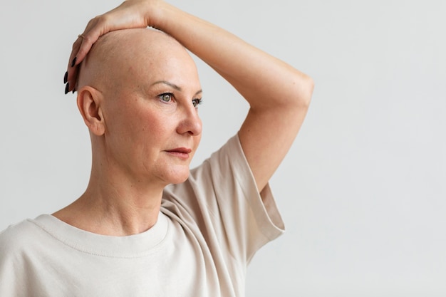 Mulher com câncer de pele com espaço de cópia