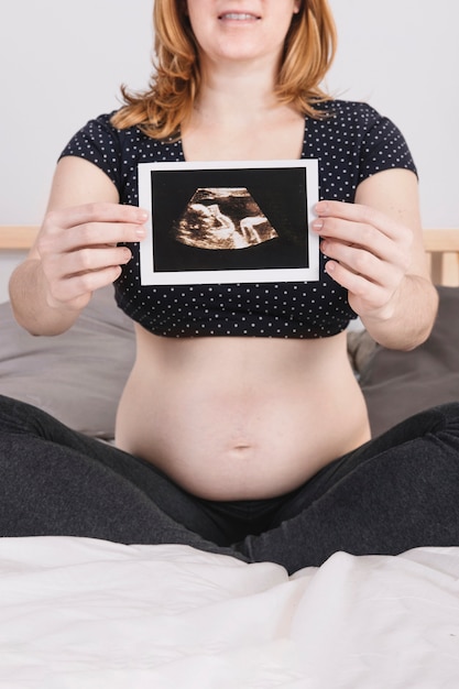 Mulher grávida, mostrando, ultrasom