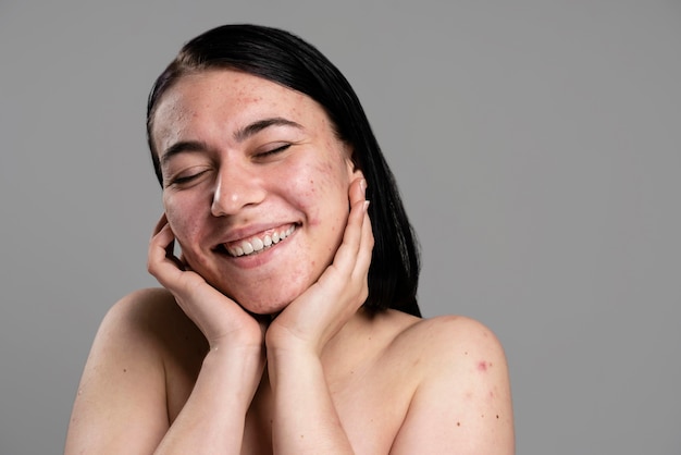 Foto grátis mulher jovem mostrando sua acne com confiança