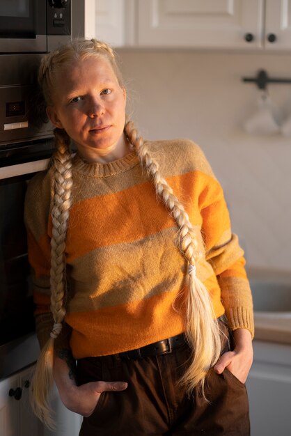Pessoa albina em casa fazendo atividades