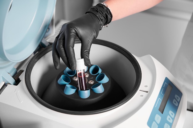 Preparação de sangue para cosmetologista de injeções coloca tubo de sangue na centrífuga