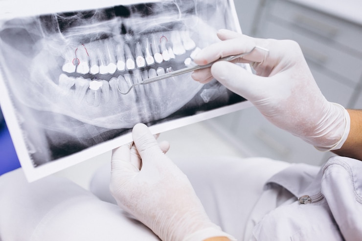 Foto grátis raio x dos dentes