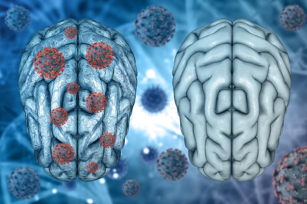 Renderização 3D de um histórico médico de cérebro saudável e cérebro doente com células do vírus Covid 19