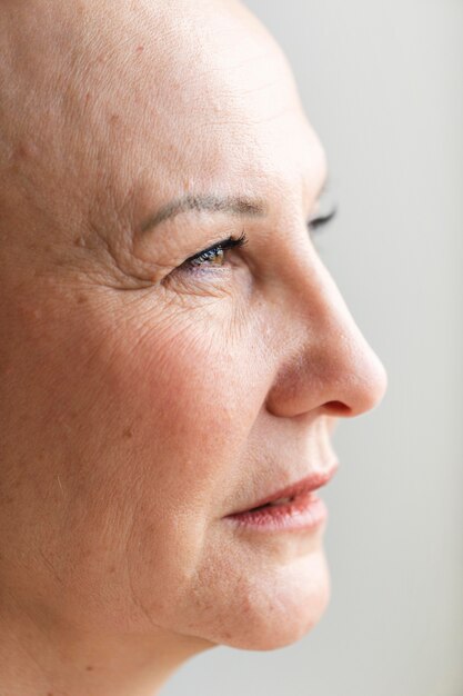 Retrato de mulher com câncer de pele