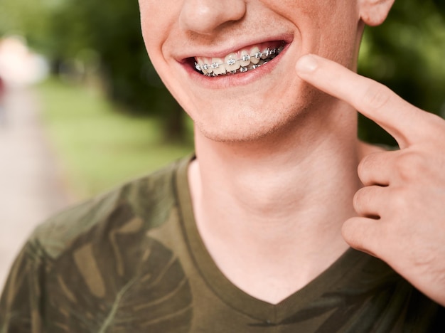 Foto grátis retrato recortado de um jovem sorrindo e demonstrando seus dentes com aparelho