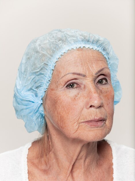 rosto de mulher de meia idade antes da cirurgia plástica