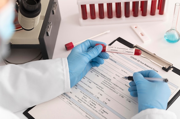 Foto grátis sortimento de amostras de sangue de coronavírus em laboratório