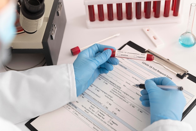Sortimento de amostras de sangue de coronavírus em laboratório