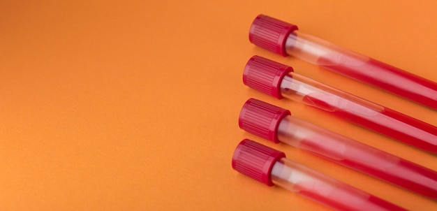 Sortimento de amostras de sangue em laranja