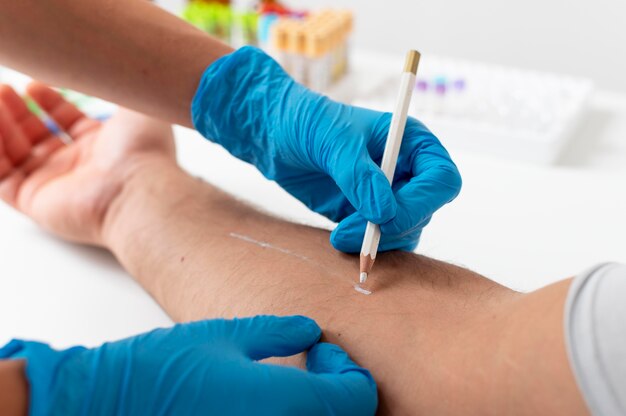 Teste de reação alérgica cutânea no braço