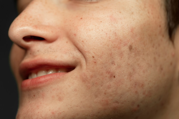 Foto grátis textura de pele de homem sorridente de vista lateral