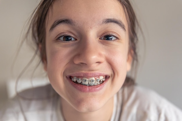 Foto grátis uma adolescente engraçada olha para a câmera e demonstra aparelhos dentários em seus dentes